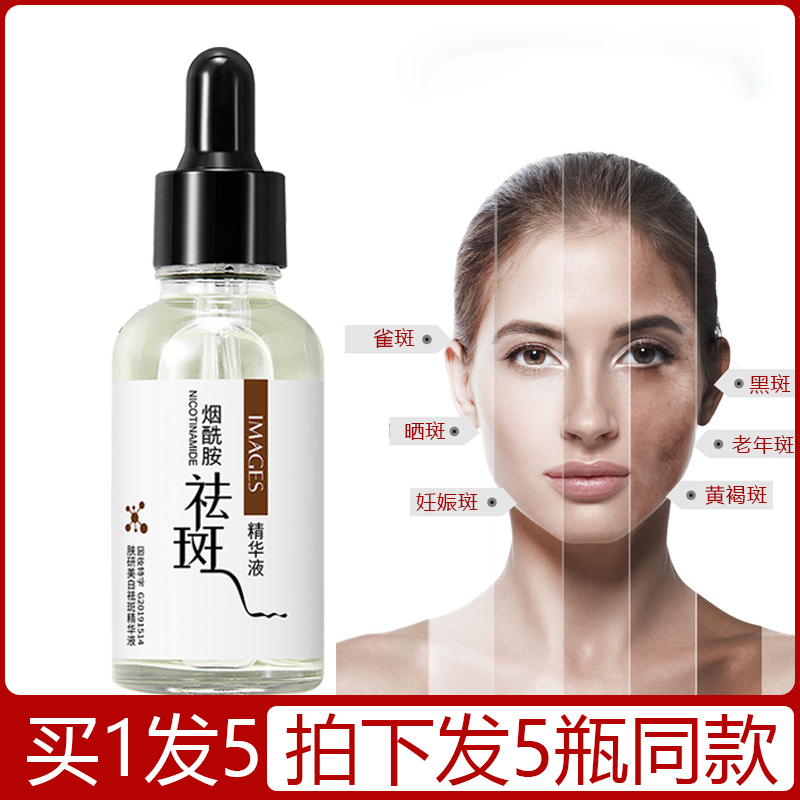 {六合彩}(十大美白淡斑精华排名olay和欧诗漫哪个好用) {六合彩}(十大美白淡斑精华排名olay和欧诗漫哪个好用)